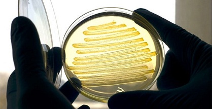 Trong khi công nghệ này vẫn còn phải đối mặt với rất nhiều thách thức về mặt thương mại, dầu diezel sản xuất bởi các chủng vi khuẩn E.coli đặc