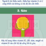 dau-hieu-thieu-vitamin-qua-ve-be-ngoai-01-min