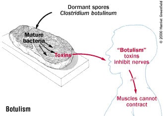 Clostridium botulinum là vi khuẩn kị khí, sinh bào tử; độc tố botulism rất mạnh. Cách nhận biết trong thực phẩm và cách phòng tránh ngộ độc